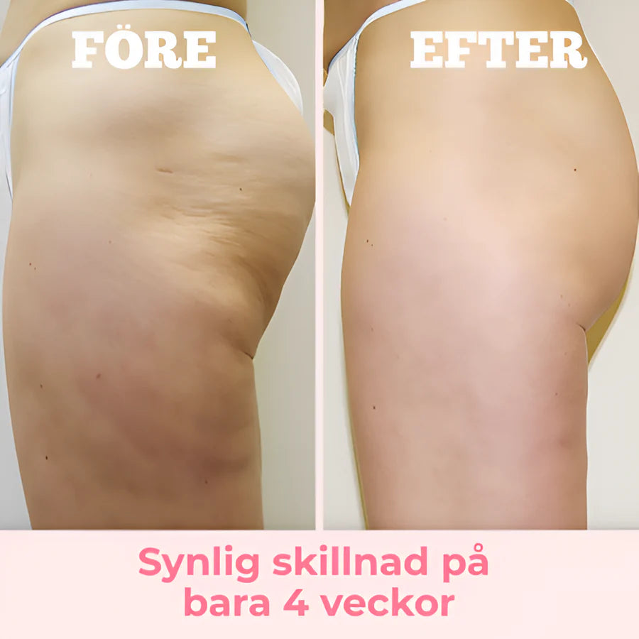 SilkRoller